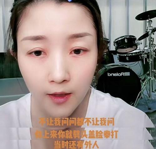 歌手网红吃瓜视频下载,揭秘娱乐圈幕后故事  第2张